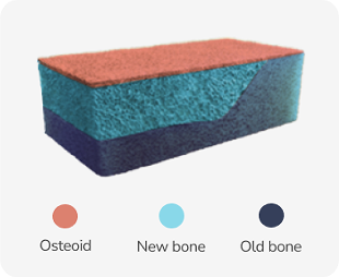 Cross-section of bone showing a thin orange layer labelled “osteoid” and thicker light blue and dark blue layers labelled “new bone” and “old bone,” respectively.