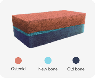 Cross-section of bone showing thick orange and dark blue layers labelled osteoid and old bone, respectively, and a thinner light blue layer labelled new bone.